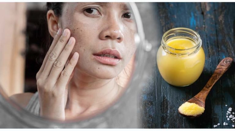सर्दियों में घी से कैसे पाए नेचुरल ग्लो त्वचा – Ghee benefits on skin